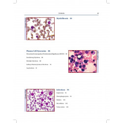 Atlas of Hematology (POD) book by Saxena - Additional Image 6