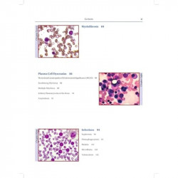 Atlas of Hematology (POD) book by Saxena - Additional Image 7