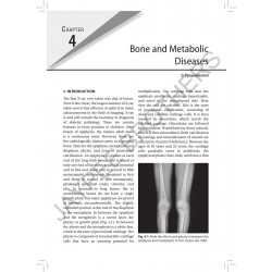 IAP Textbook of Pediatric Radiology book by TM Ananda Kesavan, S Venkateswaran - Additional Image 6