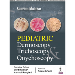 Pediatric Dermoscopy, Trichoscopy and Onychoscopy book by Subrata Malakar
