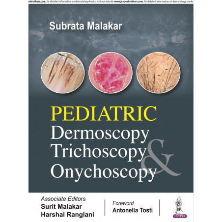 Pediatric Dermoscopy, Trichoscopy and Onychoscopy book by Subrata Malakar