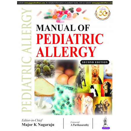 Manual of Pediatric Allergy book by Major k Nagaraju