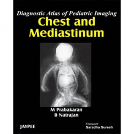 Diagnostic Atlas of Pediatric Imaging Chest and Mediastinum book by Prabakaran