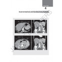 Review of Radiology, 6/E for NEET PG, INI-CET and FMGE Aspirants | MCQs with Recent Questions, Image-Based Questions, and AI… -
