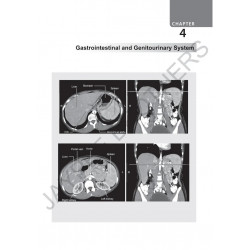 Review of Radiology, 6/E for NEET PG, INI-CET and FMGE Aspirants | MCQs with Recent Questions, Image-Based Questions, and AI… -