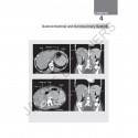 Review of Radiology, 6/E for NEET PG, INI-CET and FMGE Aspirants | MCQs with Recent Questions, Image-Based Questions, and AI… -