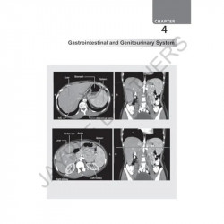 Review of Radiology, 6/E for NEET PG, INI-CET and FMGE Aspirants | MCQs with Recent Questions, Image-Based Questions, and AI… -