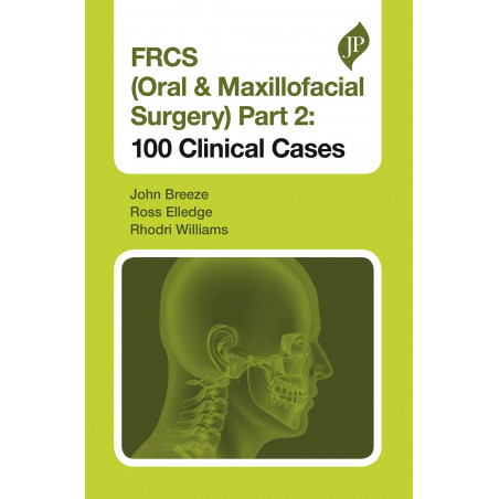FRCS (Oral & Maxillofacial Surgery) Part 2: 100 Clinical Cases (Postgraduate) book by John Breeze, Ross Elledge