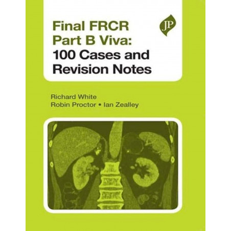 Final FRCR Part B Viva: 100 Cases and Revision Notes book by Richard White