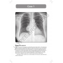 Radiology Oral Examinations: 100 Cases and Revision Notes for Radiology Postgraduates (MD/DNB) | Case-Based Viva Exam Prep w… -