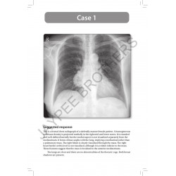Radiology Oral Examinations: 100 Cases and Revision Notes for Radiology Postgraduates (MD/DNB) | Case-Based Viva Exam Prep w… -