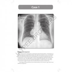 Radiology Oral Examinations: 100 Cases and Revision Notes for Radiology Postgraduates (MD/DNB) | Case-Based Viva Exam Prep w… -