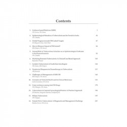 MANUAL ON TUBERCULOSIS HIV AND LUNG DISEASES A PRACTICAL APPROACH book by Arora - Additional Image 3