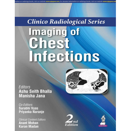 Clinico Radiological Series: Imaging of Chest Infections, 2/E for Radiology and Pulmonology Postgraduates | Organism-wise an…