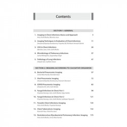 Clinico Radiological Series: Imaging of Chest Infections, 2/E for Radiology and Pulmonology Postgraduates | Organism-wise an… -