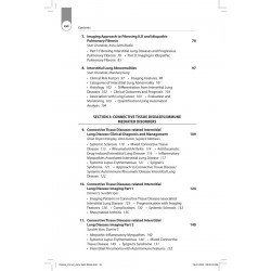 CLINICO RADIOLOGICAL SERIES IMAGING OF INTERSTITIAL LUNG DISEASES book by Ashu Seith Bhalla, Manisha Jana - Additional Image 7