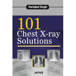 101 CHEST X-RAY SOLUTIONS book by Hariqbal Singh