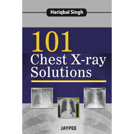 101 CHEST X-RAY SOLUTIONS book by Hariqbal Singh