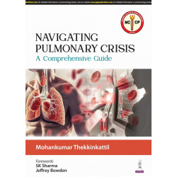 NAVIGATING PULMONARY CRISIS A COMPREHENSIVE GUIDE book by Mohankumar Thekkinkattil