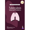 Clinical Focus Series: Tuberculosis Selected Problems (POD) book by Violeta V Mihailovic Vucinic, Dragana M Jovanovic