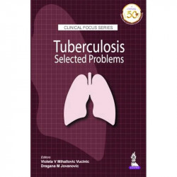 Clinical Focus Series: Tuberculosis Selected Problems (POD) book by Violeta V Mihailovic Vucinic, Dragana M Jovanovic - Back Cov