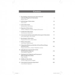 Clinical Focus Series: Tuberculosis Selected Problems (POD) book by Violeta V Mihailovic Vucinic, Dragana M Jovanovic - Addition