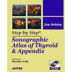 STEP BY STEP SONOGRAPHIC ATLAS OF THYROID & APPENDIX WITH PHOTO CD-ROM book by Joe Antony