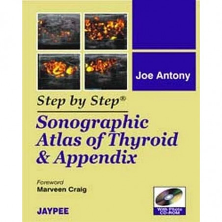 STEP BY STEP SONOGRAPHIC ATLAS OF THYROID & APPENDIX WITH PHOTO CD-ROM book by Joe Antony