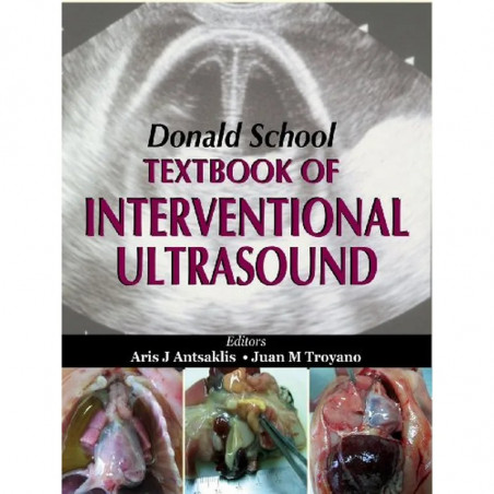 Donald School Textbook of Interventional Ultrasound book by Antsaklis