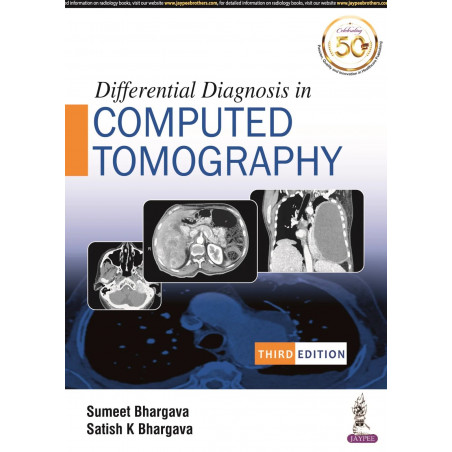 DIFFERENTIAL DIAGNOSIS IN COMPUTED TOMOGRAPHY book by Sumeet Bhargava, M.D. Bhargava, Satish K.