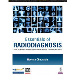 ESSENTIALS OF RADIODIAGNOSIS book by Rachna Chaurasia