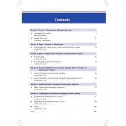 BREAST ELASTOGRAPHY BASIC PRINCIPLES AND INTERPRETATION OF CLINICAL CASES book by Christina An. Gkali, Constantine Dimitraka… -