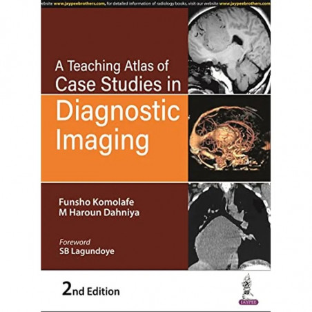A Teaching Atlas of Case Studies in Diagnostic Imaging book by Funsho Komolafe, (Late) M Haroun Dahniya