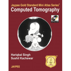 Jaypee Gold Standard Mini Atlas Series Computed Tomography with Photo CD-ROM book by Singh