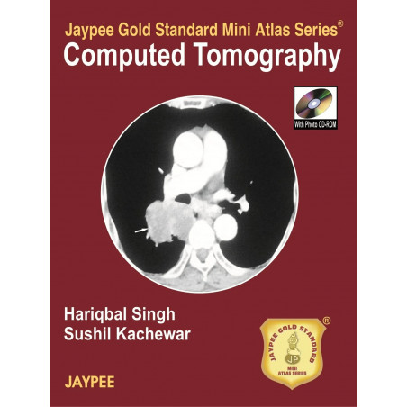 Jaypee Gold Standard Mini Atlas Series Computed Tomography with Photo CD-ROM book by Singh