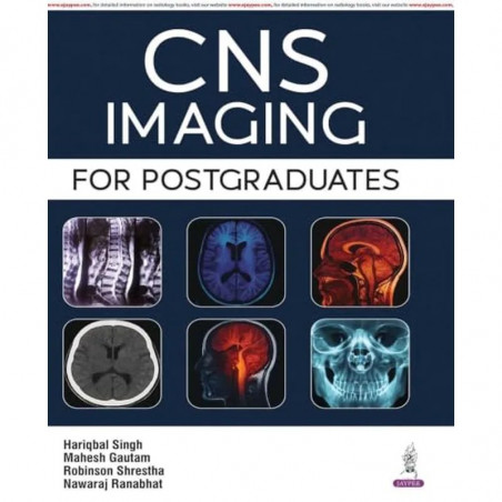 CNS IMAGING FOR POSTGRADUATES book by Hariqbal Singh, Mahesh Gautam