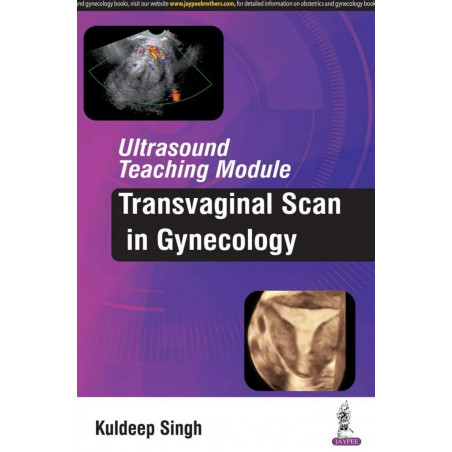 ULTRASOUND TEACHING MODULE:TRANSVAGINAL SCAN IN GYNECOLOGY book by Singh Kuldeep