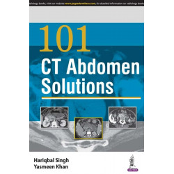 101 CT ABDOMEN SOLUTIONS book by Singh Hariqbal