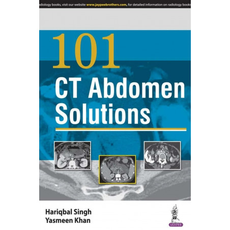 101 CT ABDOMEN SOLUTIONS book by Singh Hariqbal