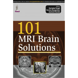 101 MRI Brain Solutions (POD) book by Singh Hariqbal