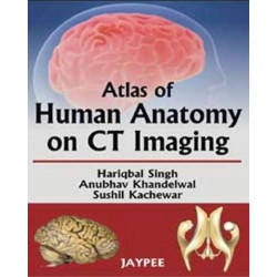 Atlas of Human Anatomy on CT Imaging book by Singh Hariqbal