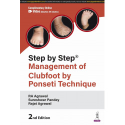 STEP BY STEP MANAGEMENT OF CLUBFOOT BY PONSETI TECHNIQUE book by RA Agrawal, Sureshwar Pandey