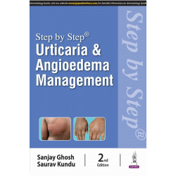 Step by Step: Urticaria & Angioedema Management book by Sanjay Ghosh, Saurav Kundu