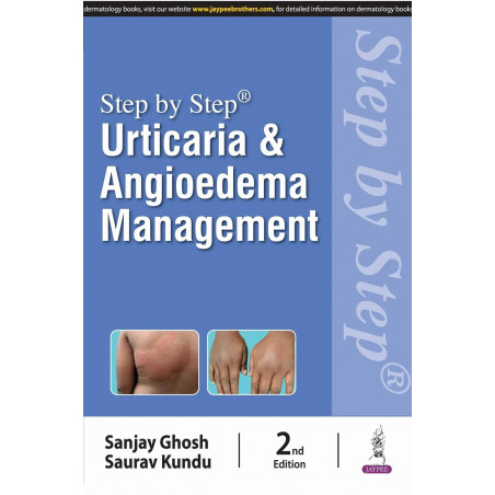 Step by Step: Urticaria & Angioedema Management book by Sanjay Ghosh, Saurav Kundu