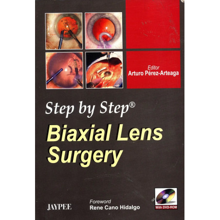 Step By Step Biaxial Lens Surgery with DVD-ROM book by Perez-Arteaga