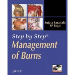 STEP BY STEP MANAGEMENT OF BURNS WITH PHOTO CD-ROM book by Sarabahi