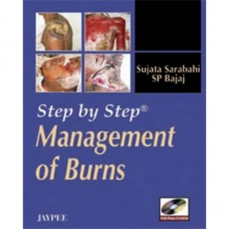 STEP BY STEP MANAGEMENT OF BURNS WITH PHOTO CD-ROM book by Sarabahi