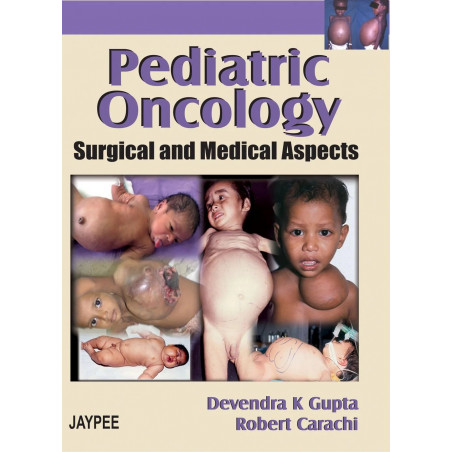 Pediatric Oncology: Surgical and Medical Aspects (POD) book by Gupta