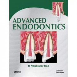 Advanced Endodontics book by Rao