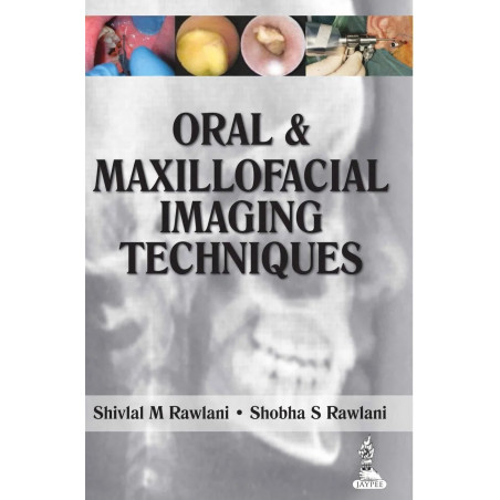 ORAL & MAXILLOFACIAL IMAGING TECHNIQUES book by Rawlani Shivlal